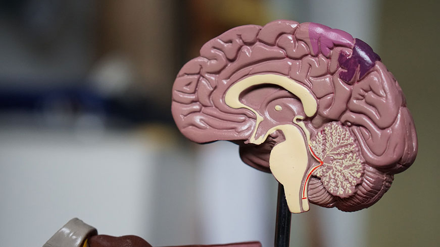 Picture of plastic model of a brain