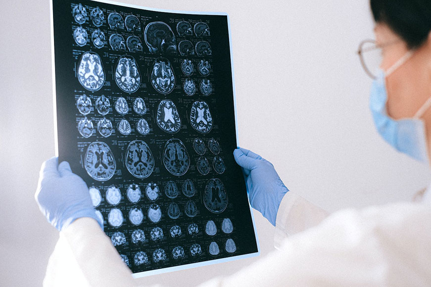 Picture of doctor reading brain scans